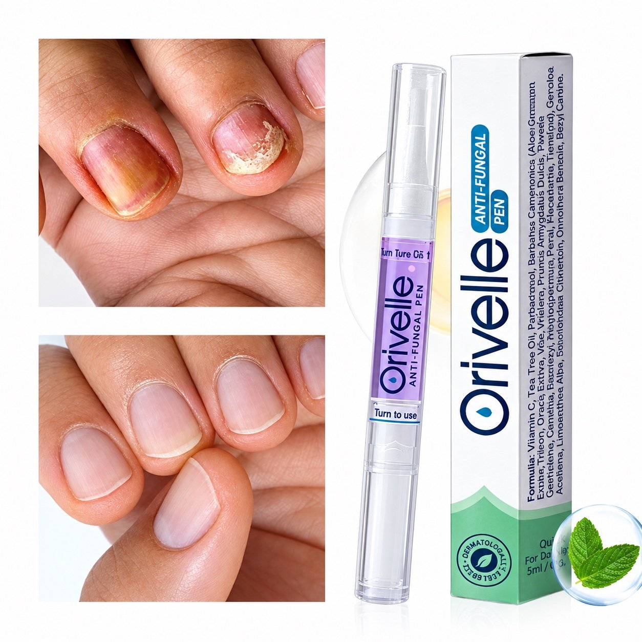Orivelle pen with product carton and nail appearance comparison